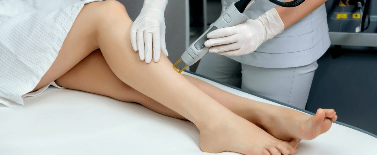 Laser Hair Removal