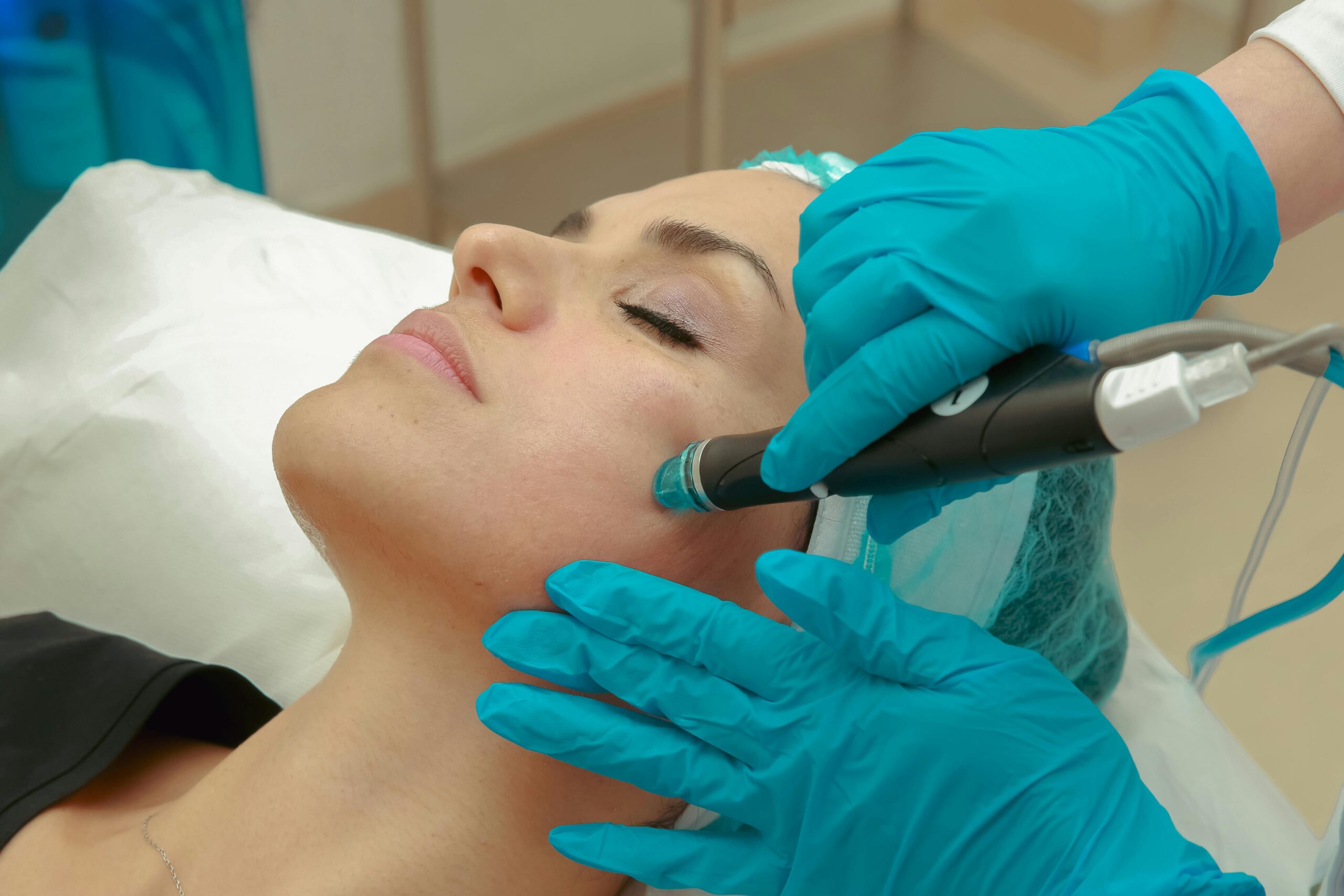 RF SUBLATIVE SKIN REJUVENATION